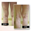Before and After Pictures