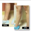 Before and After Pictures