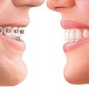 Invisalign dentist