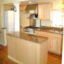 After refacing