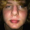 snake bite piercing