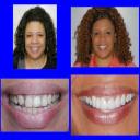 TMJ Treatment in Cincinnati, OH