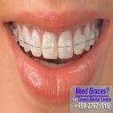 Teeth Whitening London