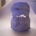 Root Canal Technology in Wichita KS