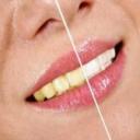 routine dental care in Philadelphia, PA