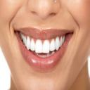 Teeth Whitening Los Gatos, CA