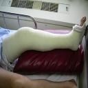 Dartmouth MA personal injury lawyer