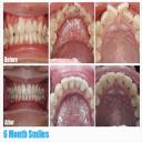 Best Cosmetic Dentist in Burnaby, BC