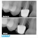 Best Dentist Burnaby, BC