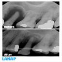 Cosmetic Dentistry in Burnaby, BC