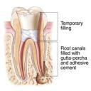 Endodontics in Glendale, AZâ€Ž